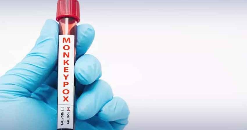 18-Month-Old Child Dies of Mpox in Karachi During Treatment